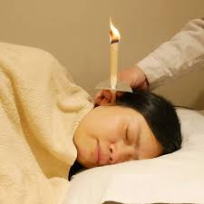 Hopi Ear Candle Treatment Lincoln